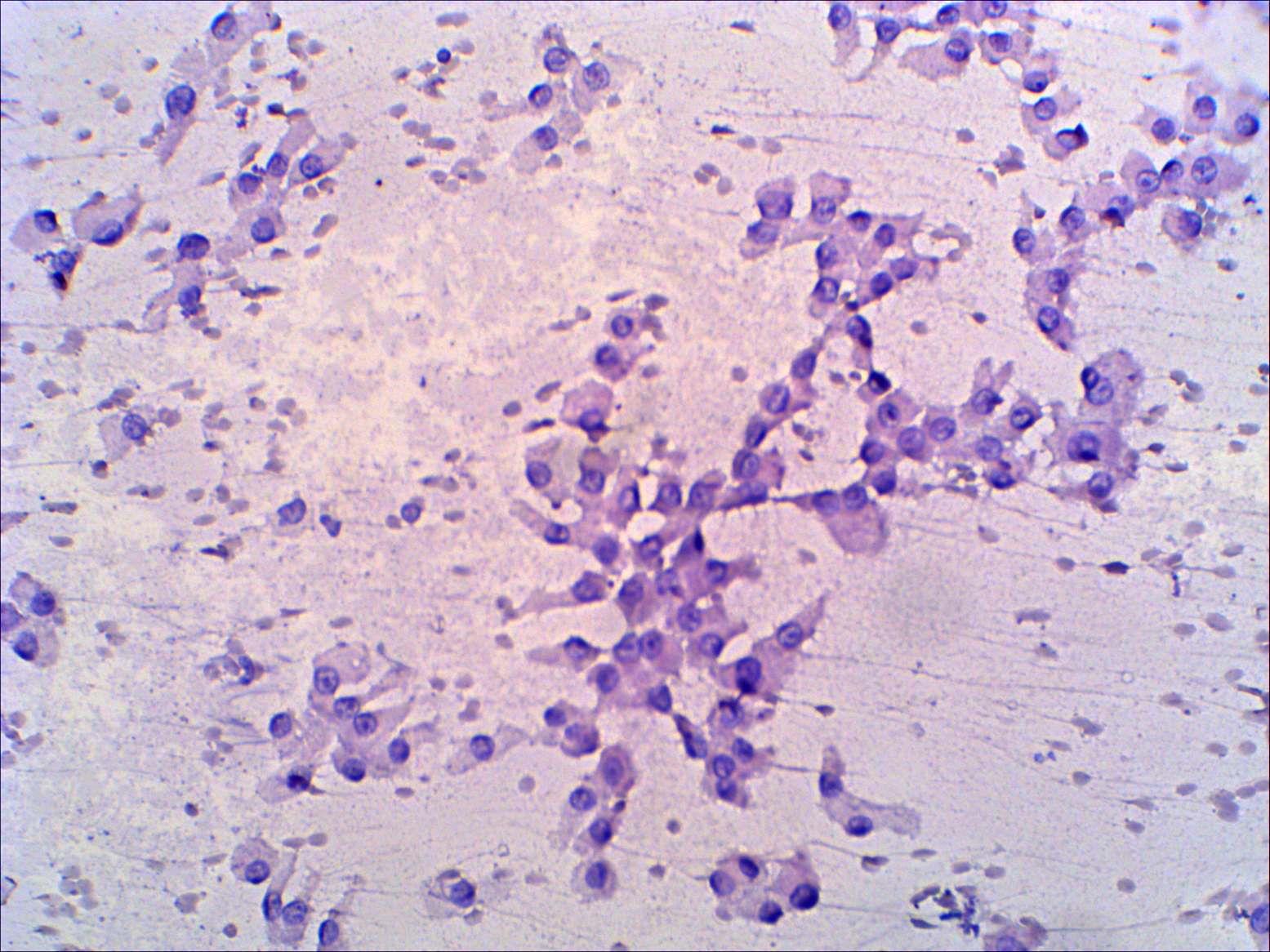 Right lobe, longitudinal scan