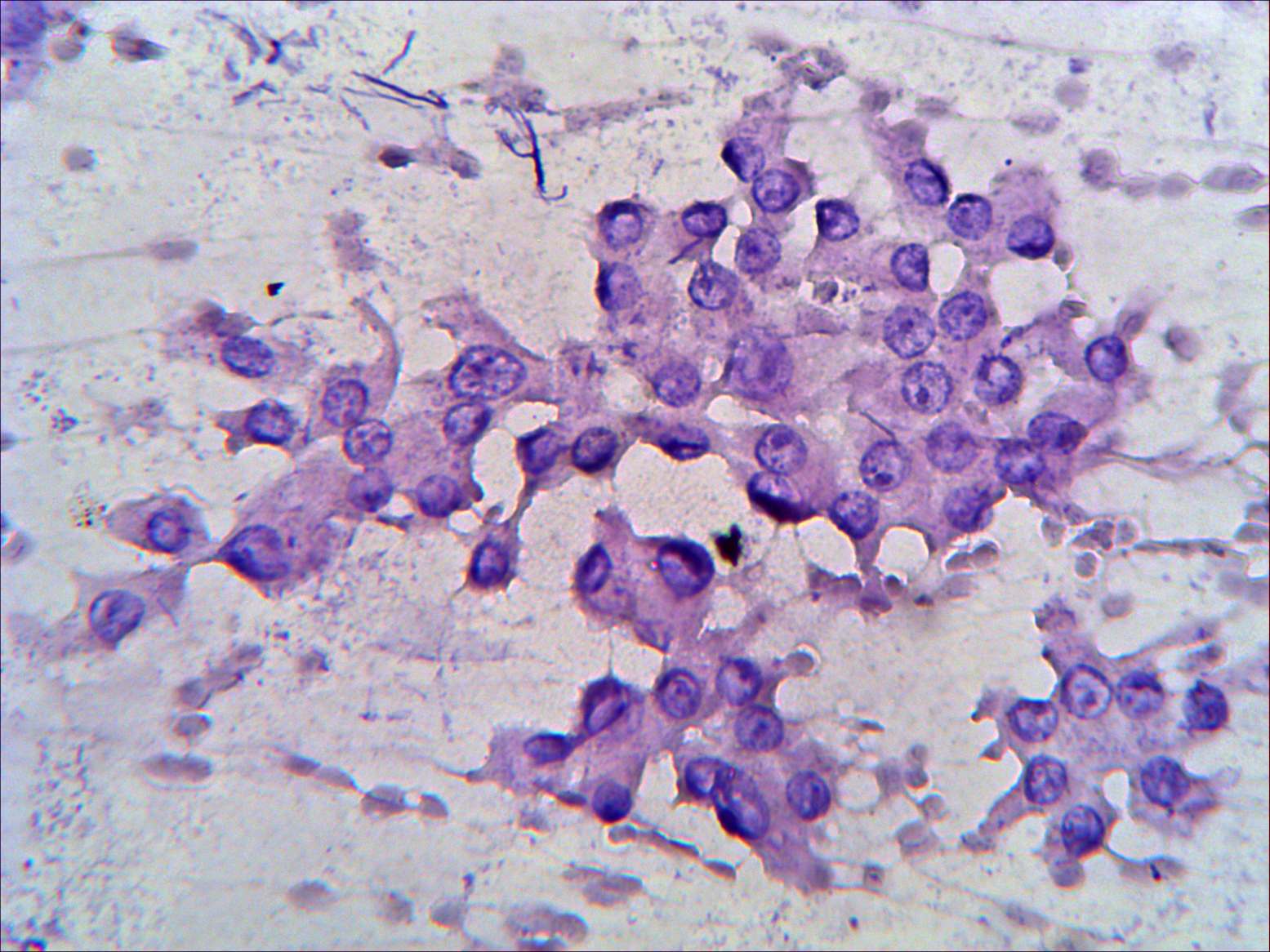 Right lobe, longitudinal scan