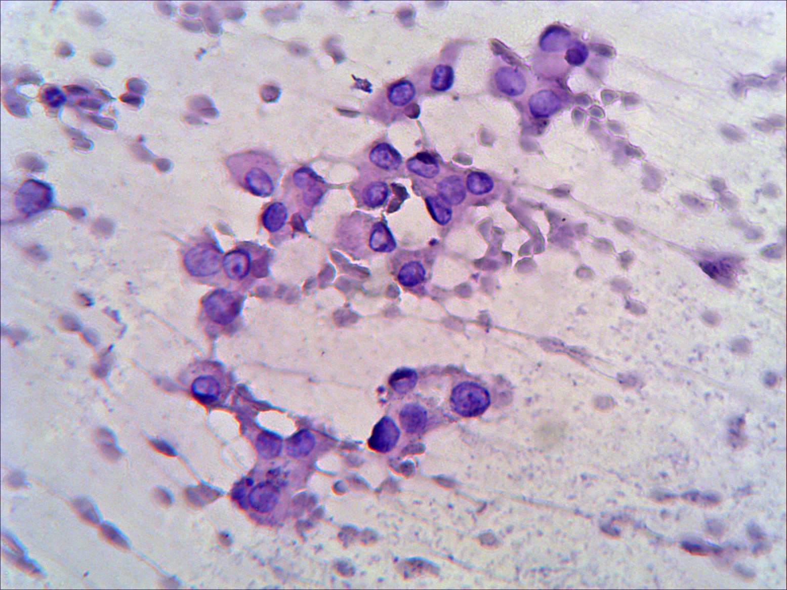 Right lobe, longitudinal scan