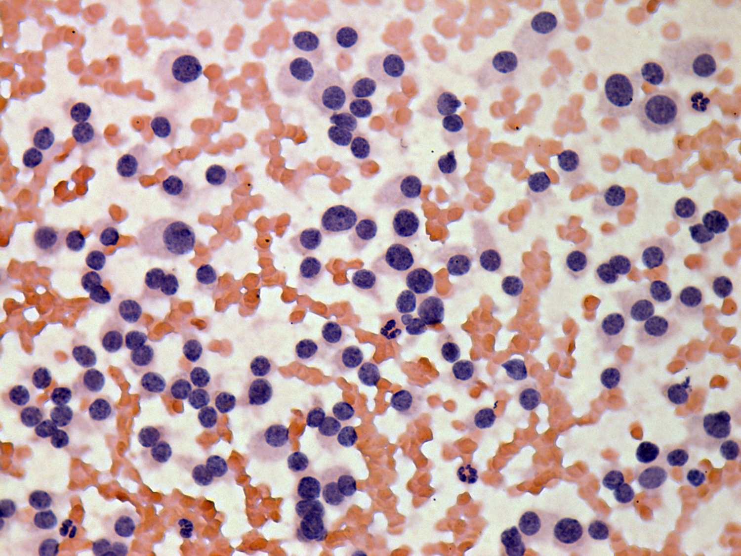 Right lobe, longitudinal scan