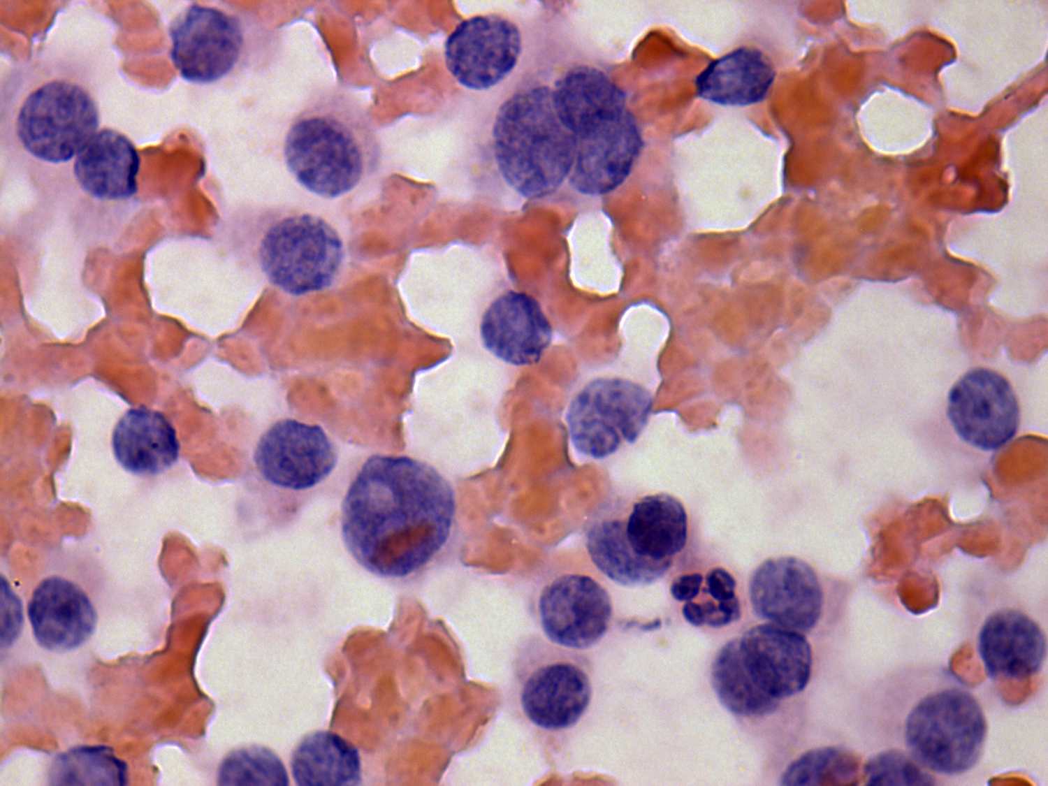 Right lobe, longitudinal scan