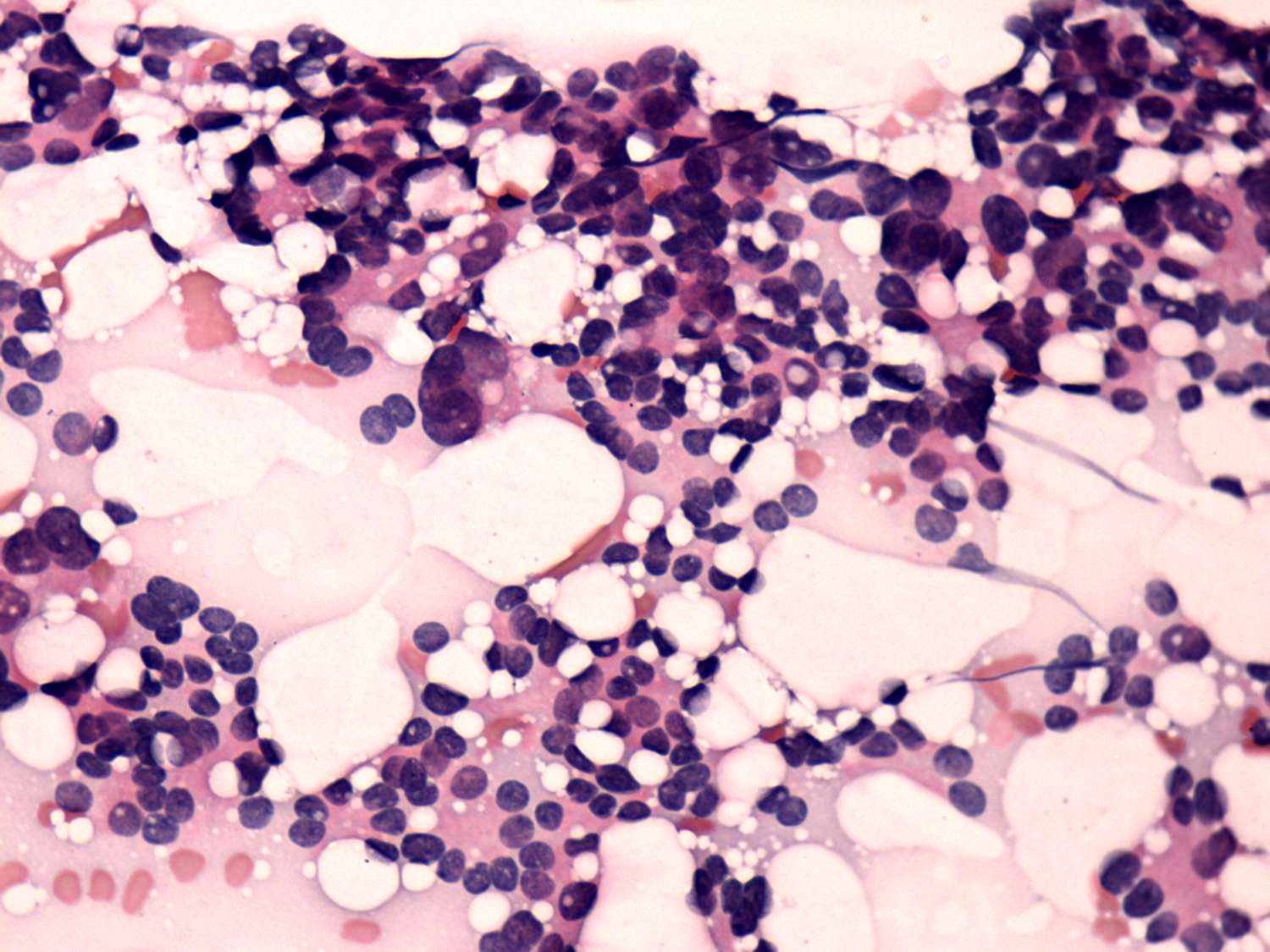 Right lobe, longitudinal scan