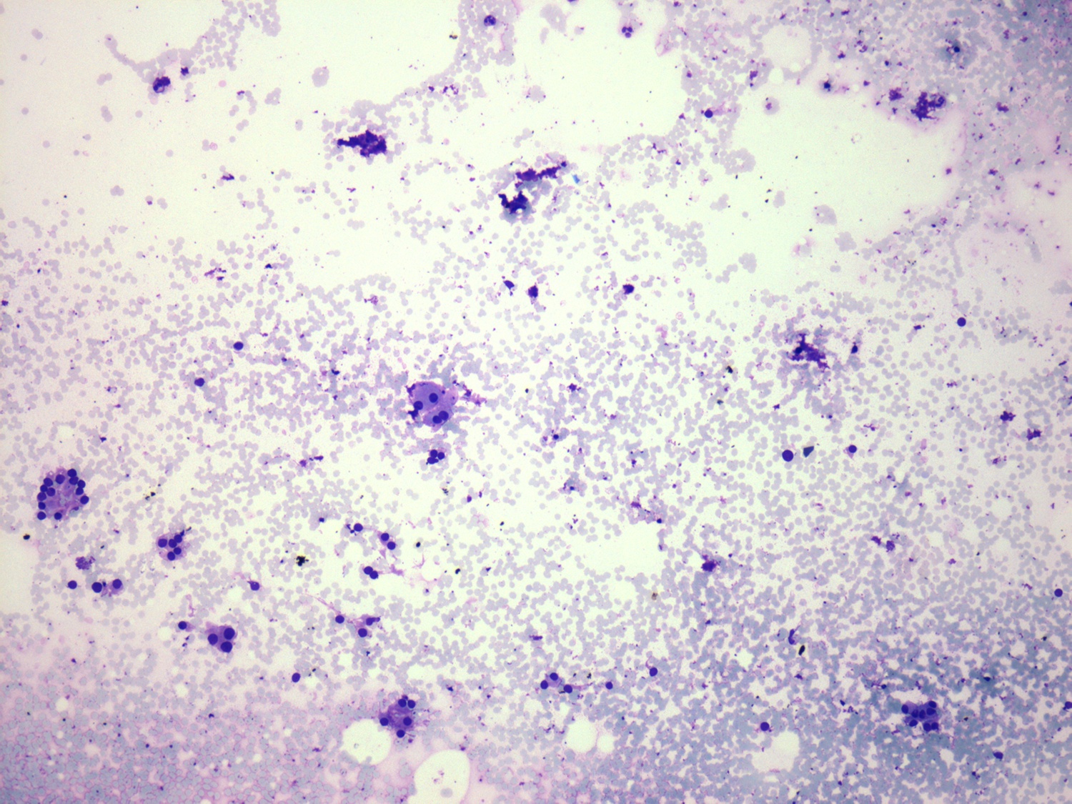 Right lobe, longitudinal scan