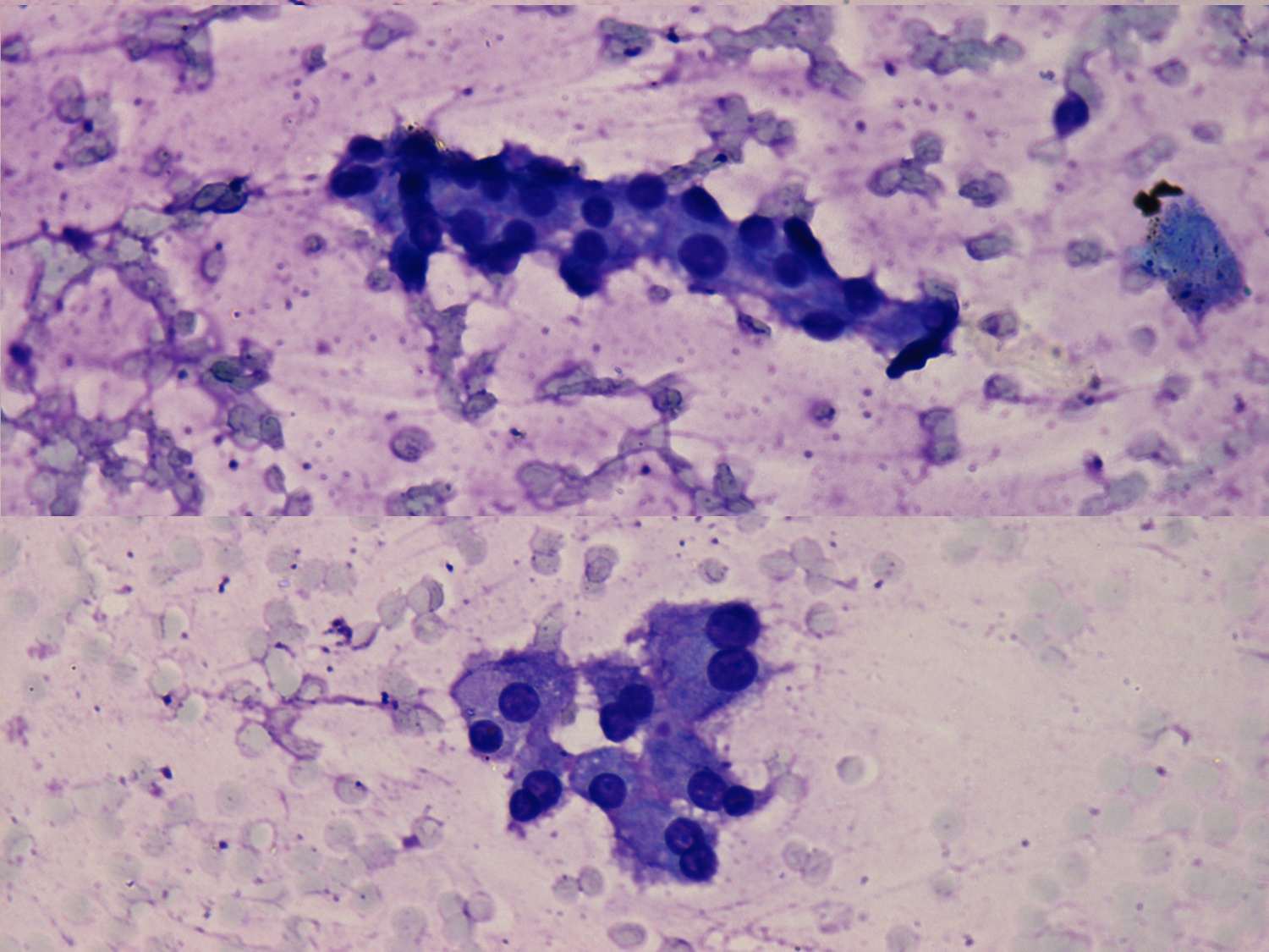 Right lobe, longitudinal scan