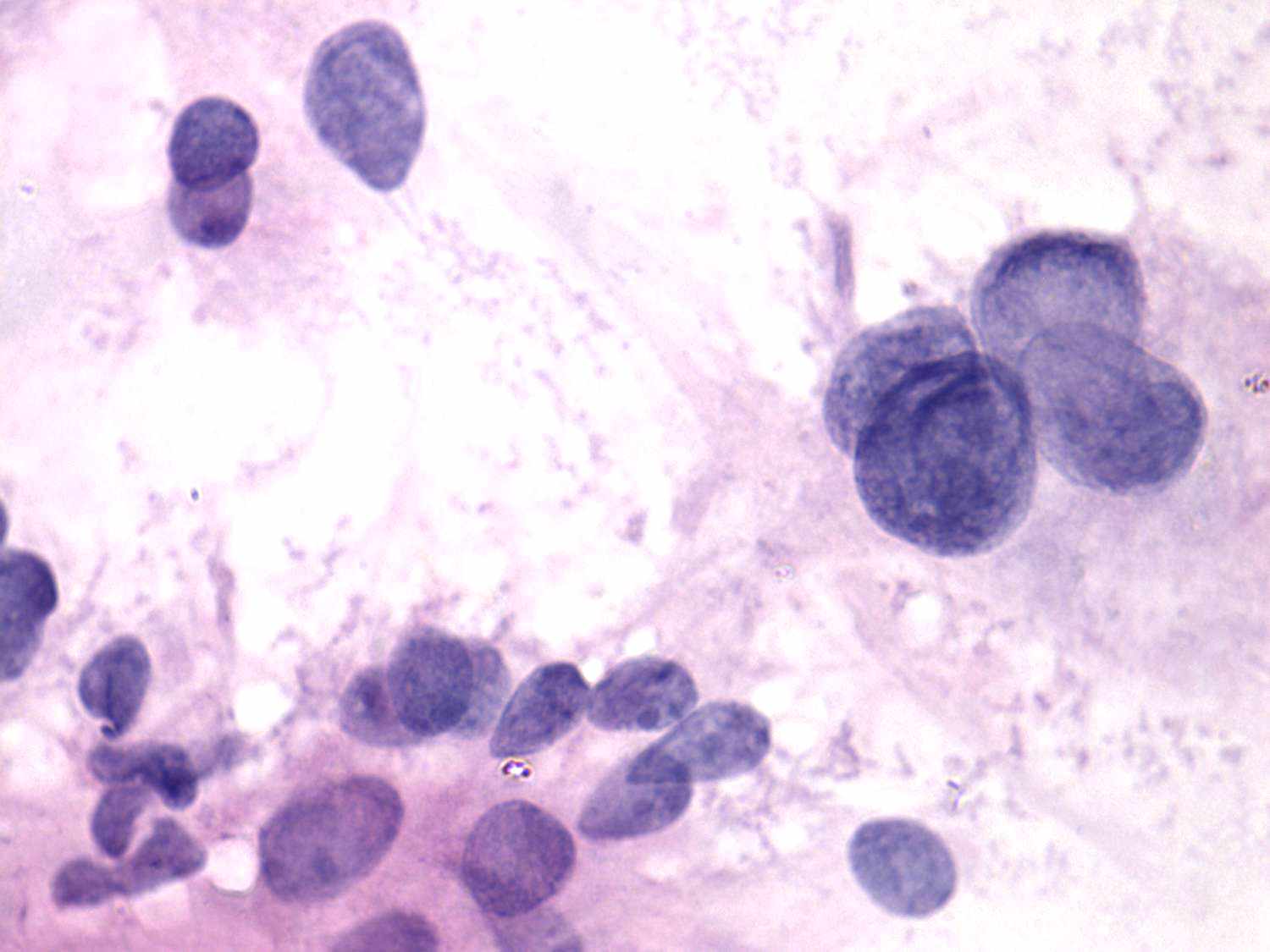 Right lobe, longitudinal scan