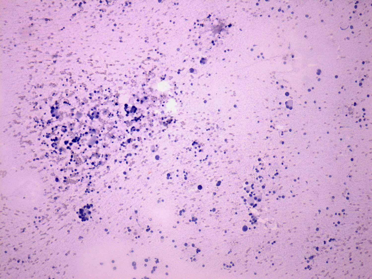 Right lobe, longitudinal scan