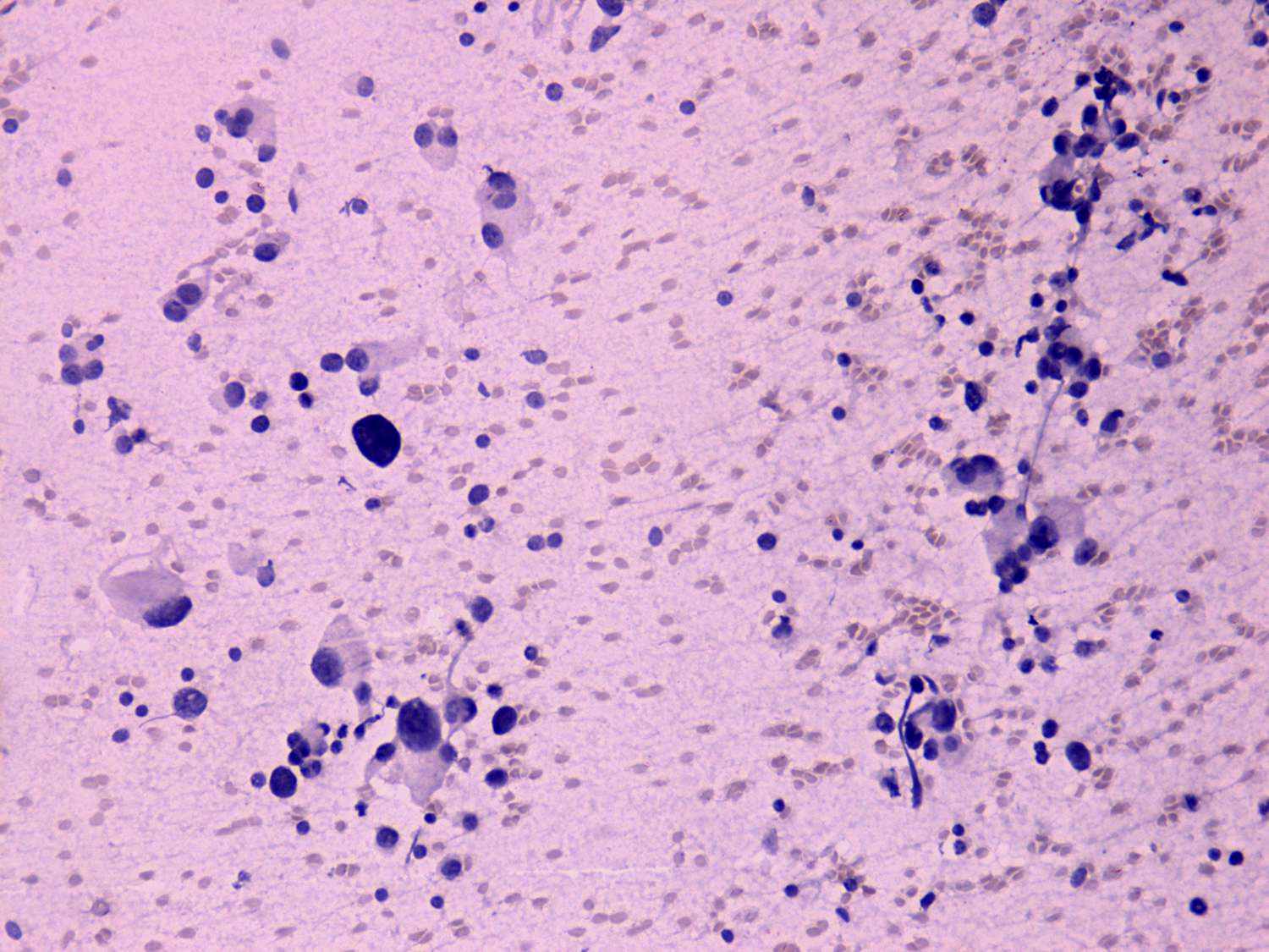Right lobe, longitudinal scan