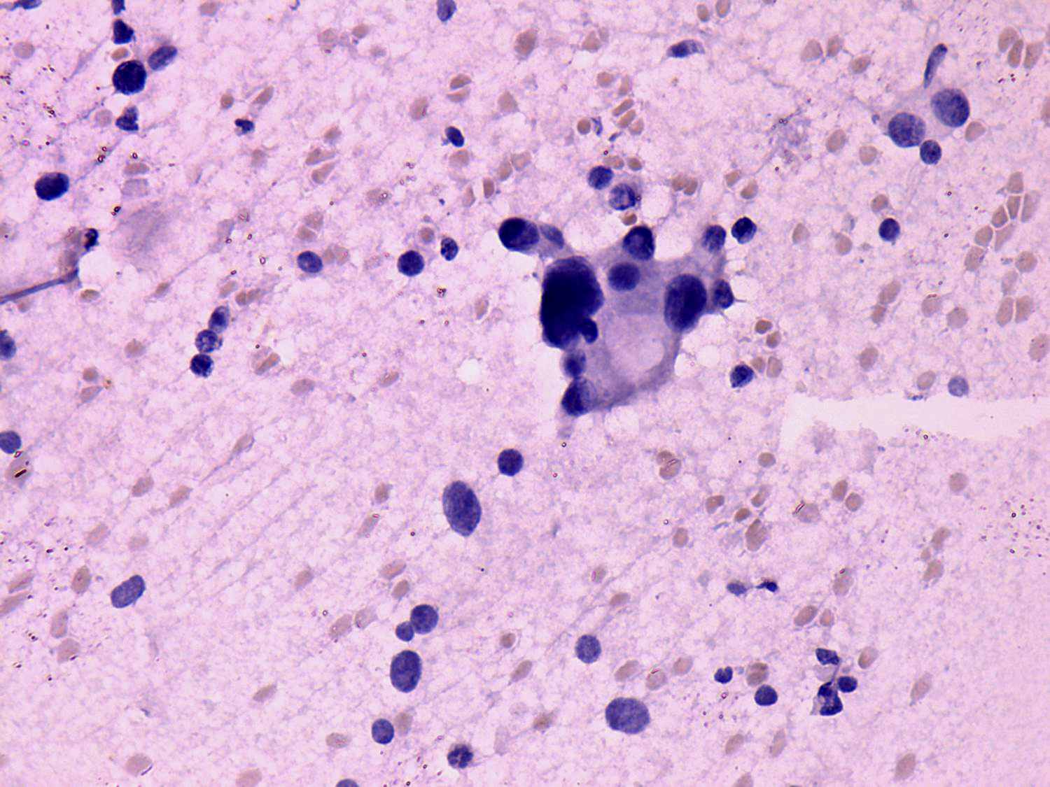 Right lobe, longitudinal scan