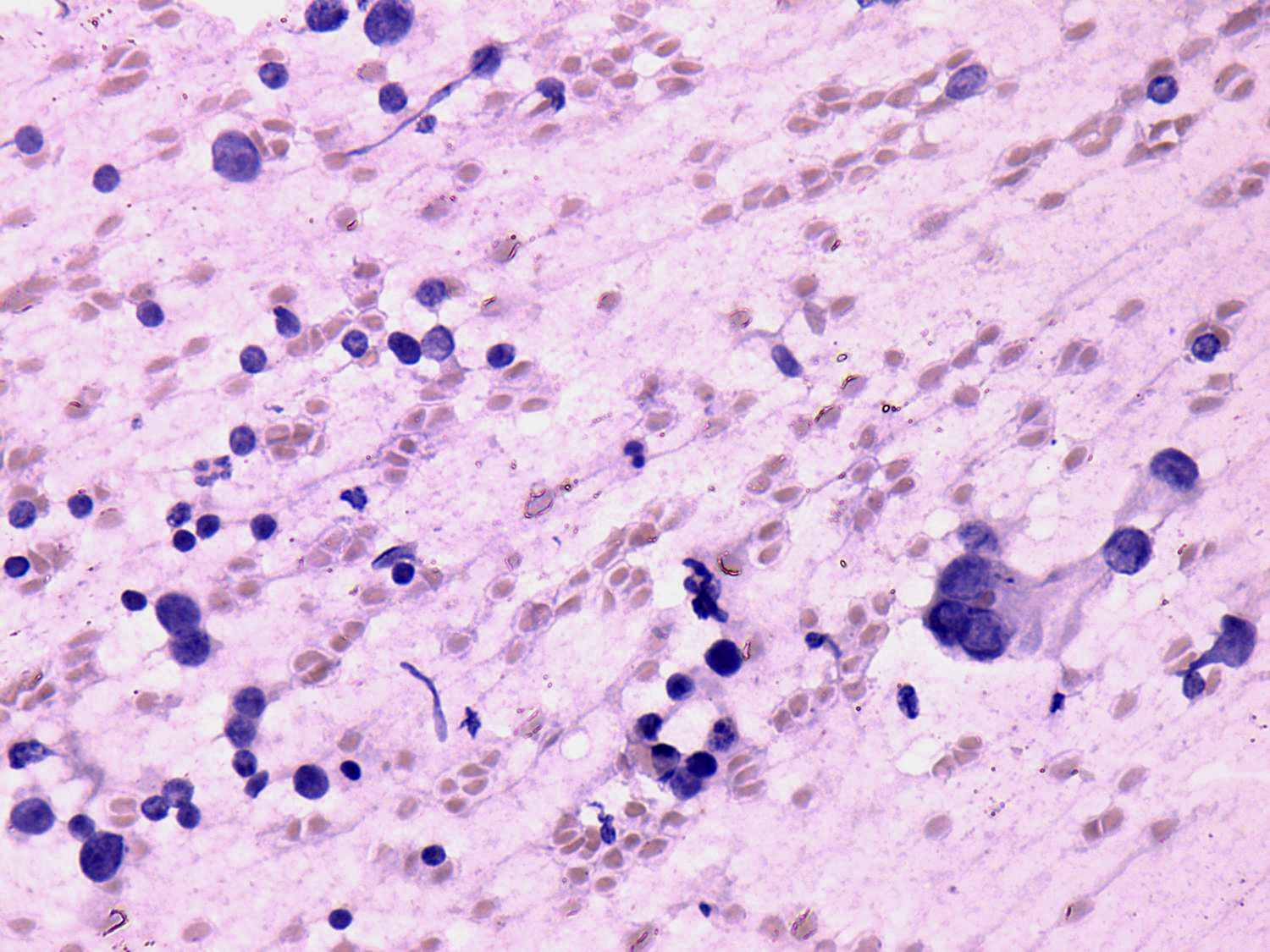 Right lobe, longitudinal scan
