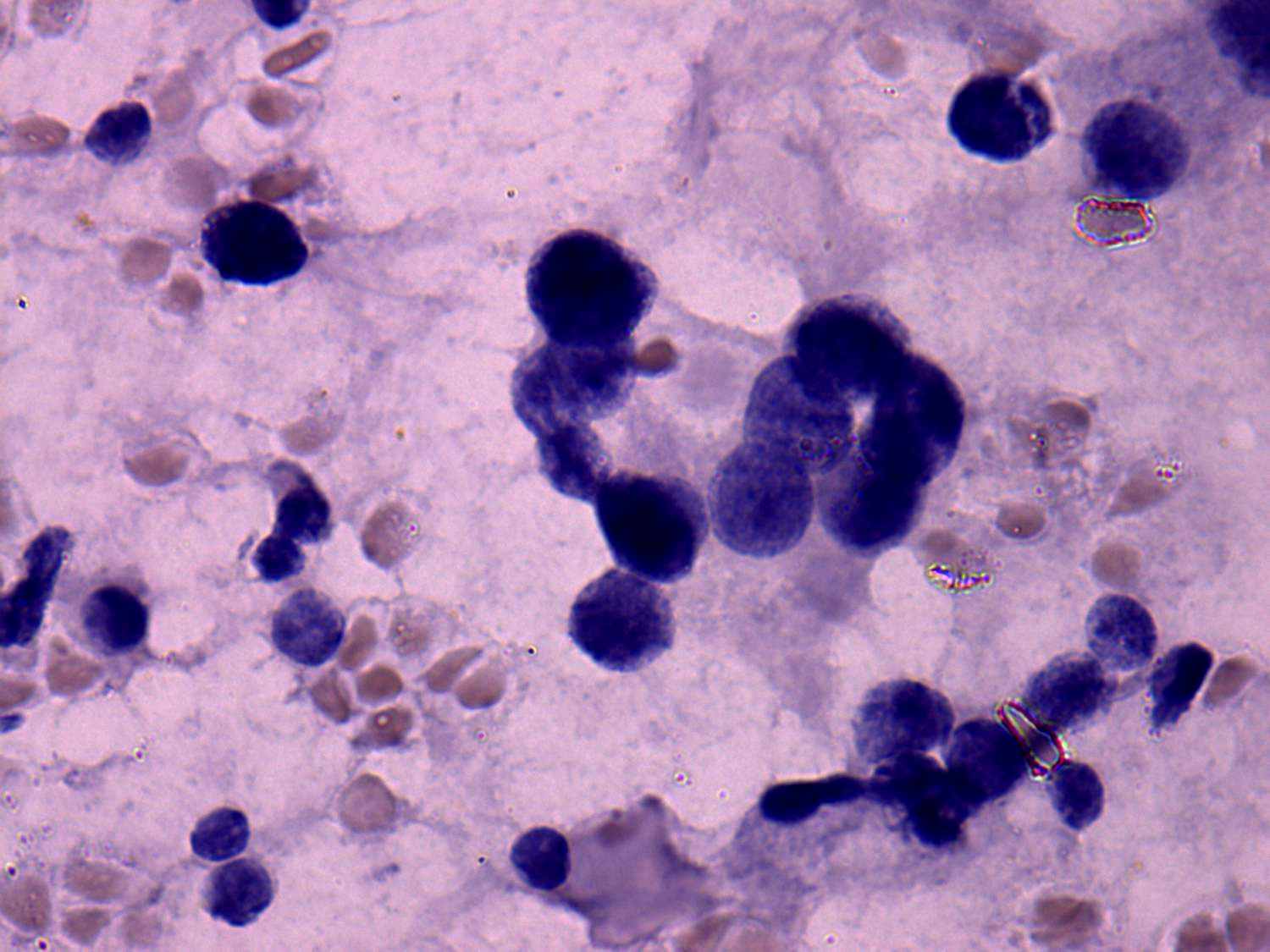 Right lobe, longitudinal scan